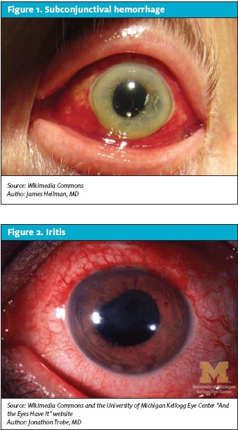 Ocular Complaints in Urgent Care