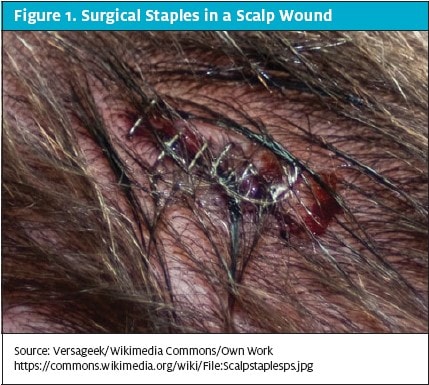 Repair of Lacerations of Face and Scalp