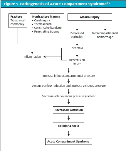 Acute Compartment Syndrome