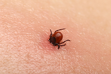 High Season for Ticks May Mean Higher Urgent Care Traffic in Vacation Spots
