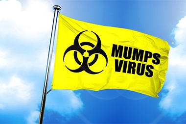 CDC: Mumps Cases Surpass 2017’s Total, with New York and Michigan Leading the Way