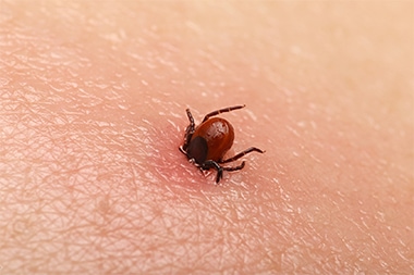 Did Your Urgent Care Center See More Tick-Related Visits Last Year? You’re Not Alone