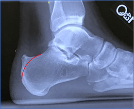 Top 5 Common Causes—and Controversial Conducts—of Heel Pain in Urgent ...