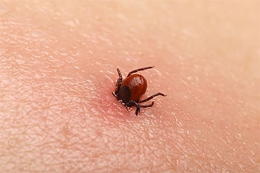 Beware—and Be Prepared: Tick-Borne Diseases Are on the Rise
