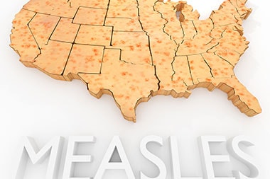Warn Patients: Before Going on Vacation, Know the Measles Situation Where You’re Heading