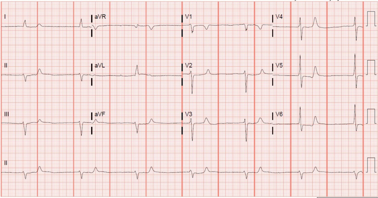 A 50-year-old Male With Several Chronic Conditions And Foot Pain At An 