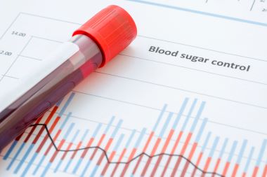 Here’s One More Dire Reason to Be Aware of Fasting Blood Glucose in COVID-19