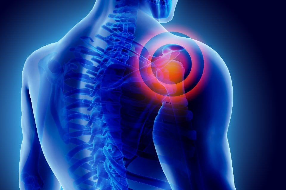 Posterior Shoulder Pain Not Always A Muscle Spasm Journal Of Urgent 