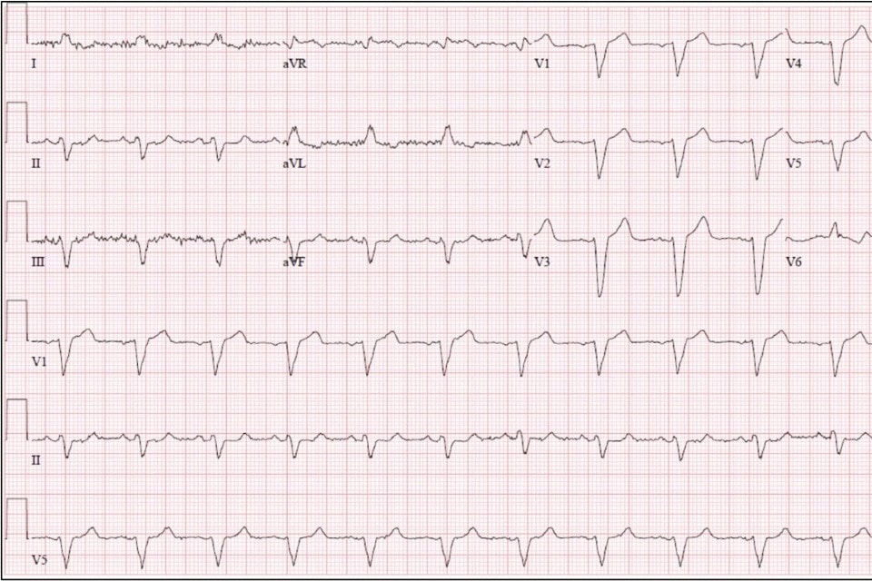 A 77-Year-Old Man Presents with Dyspnea - Journal of Urgent Care Medicine