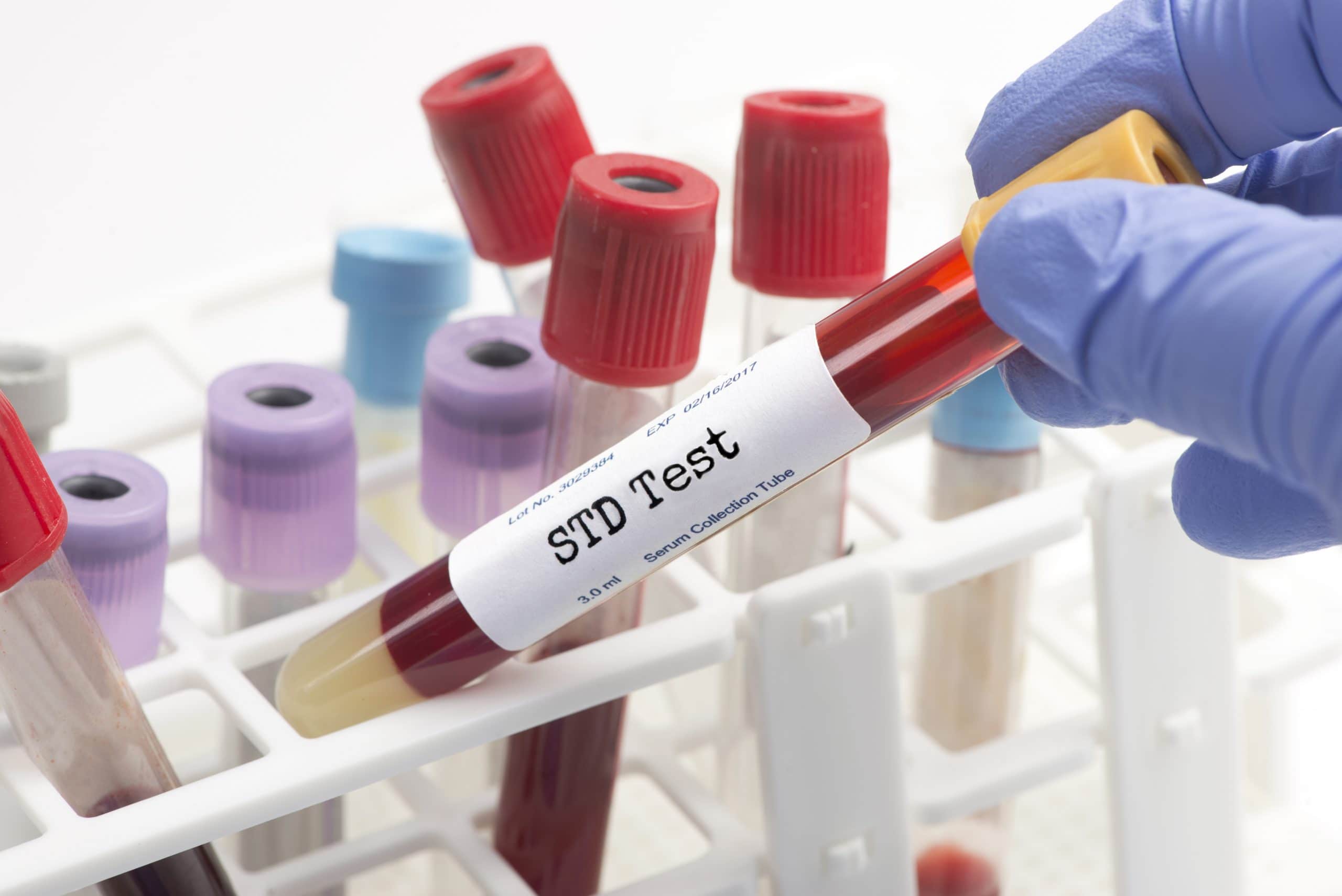 Standard test. Веб исследование крови. STD тест. Blood Analysis.