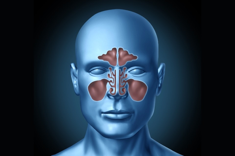 antibiotic-prescribing-patterns-for-sinusitis-in-an-urgent-care-and