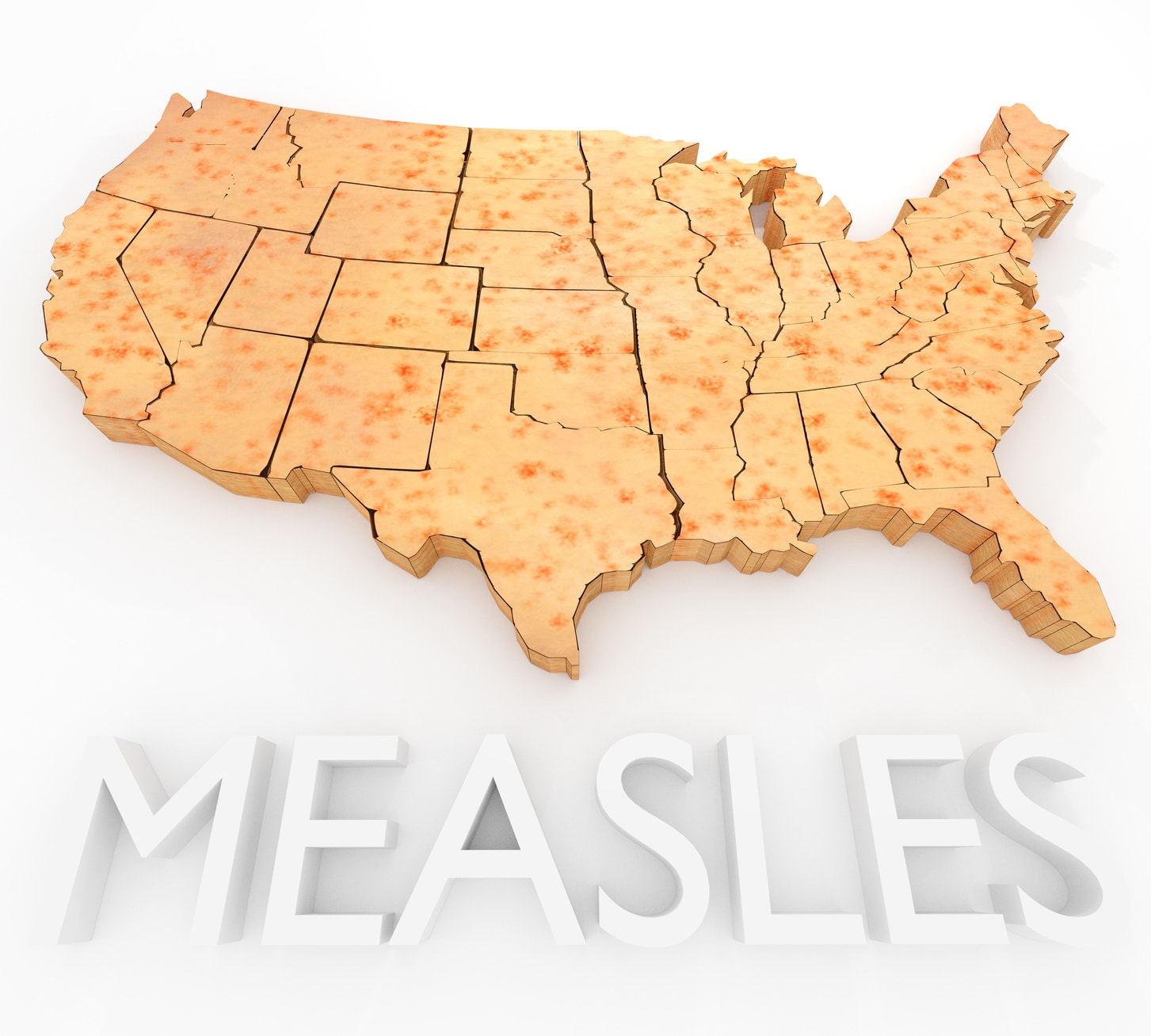 Update: Will The Measles Outbreak Creeping Across The Midwest Be ...