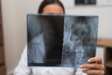 How Proposed Michigan Rule Reduces the Pool of X-ray Techs