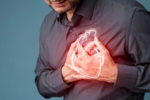 Major Adverse Cardiovascular Events Referred