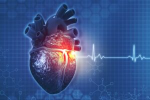 Spontaneous Coronary Artery Dissection