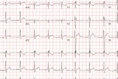 16-Year-Old With History Of Orchiopexy