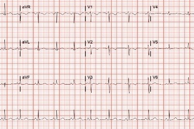 27-Year-Old with History of Asthma