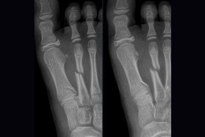 7-Year-Old With Playground Injury