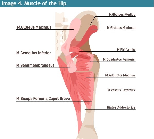 Hip Osteoarthritis in Urgent Care