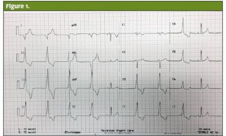 cholecystitis