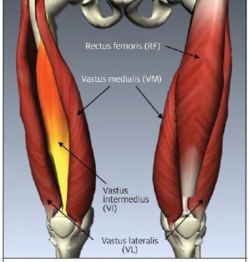 Thigh Pain: Thigh Anatomy