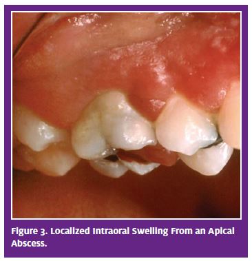 An Urgent Care Provider&rsquo;s Guide to Managing Dental Emergencies 