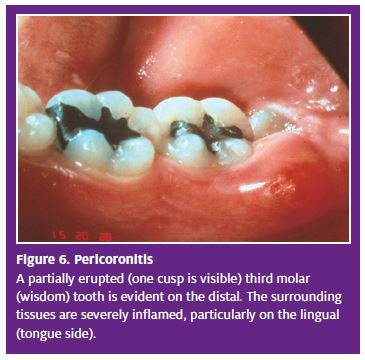 An Urgent Care Provider&rsquo;s Guide to Managing Dental Emergencies 