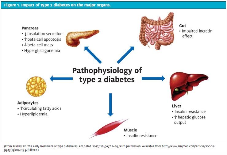 Diabetes Mellitus Nursing Care Plans 17 Nursing Diagnosis