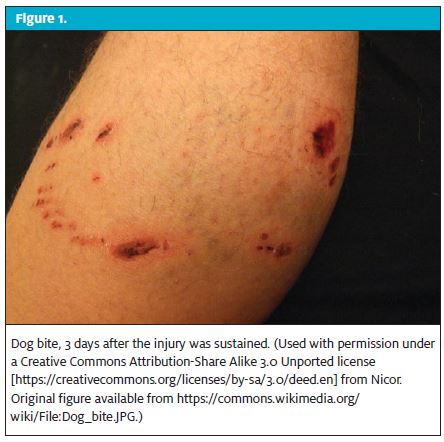 Urgent Care Management of Animal Bites and Stings
